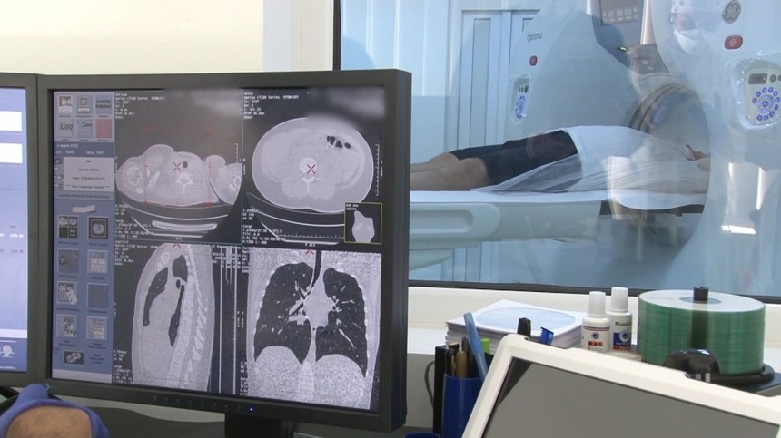 Spitalul de Boli Infecţioase din Timişoara nu mai poate realiza investigaţii imagistice de tip CT persoanelor infectate cu SARS-CoV-2, după ce s-a defectat aparatul