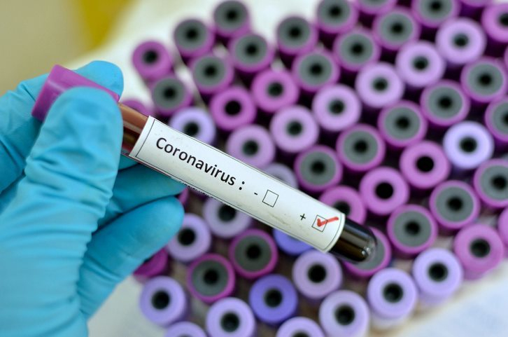 Grupul de Comunicare Strategică: 5.719 noi cazuri de infectare cu noul coronavirus şi 34.343 de teste făcute în ultimele 24 de ore/ S-au înregistrat 121 de decese / 1.070 pacienţi la ATI